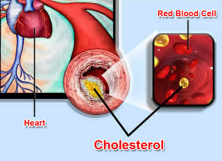  Cholesterol lẫn vào trong máu làm giảm khả năng vận chuyển máu và sự co bóp của tim mạch